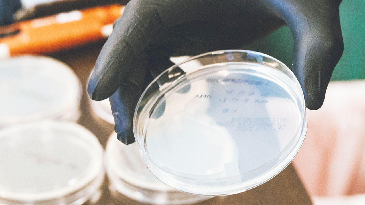 El plástico en los tiempos del residuo cero