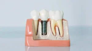 Formulaciones para impresión 3D y 4D: poliacrilatos multifuncionales
