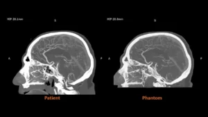 Stratasys anuncia la disponibilidad comercial total de RadioMatrix, su material de impresión 3D radiopaco
