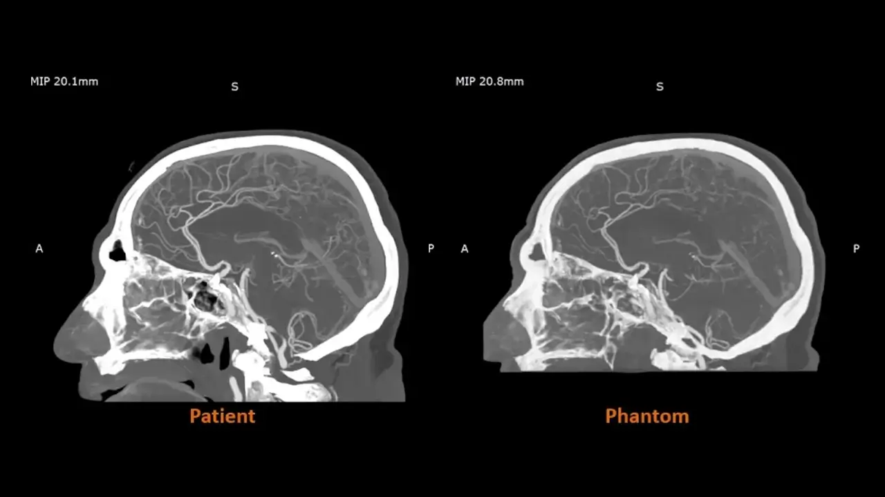 Stratasys anuncia la disponibilidad comercial total de RadioMatrix, su material de impresión 3D radiopaco